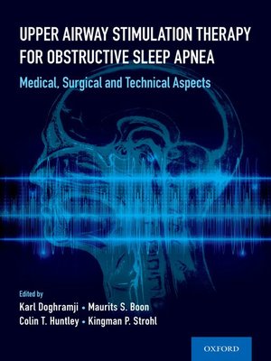 cover image of Upper Airway Stimulation Therapy for Obstructive Sleep Apnea